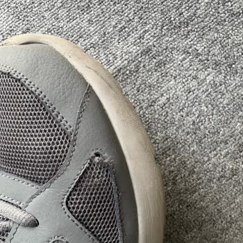 Skechers Ayakkabıda 7 Ayda Sökülme Ve Destek Talebi Hayal Kırıklığı