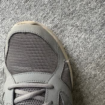 Skechers Ayakkabıda 7 Ayda Sökülme Ve Destek Talebi Hayal Kırıklığı