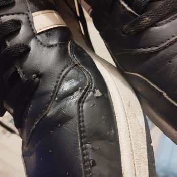 Adidas Ayakkabıda Beklenmedik Deri Soyulması Sorunu