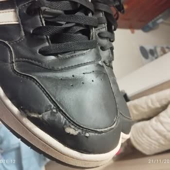 Adidas Ayakkabıda Beklenmedik Deri Soyulması Sorunu