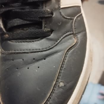 Adidas Ayakkabıda Beklenmedik Deri Soyulması Sorunu