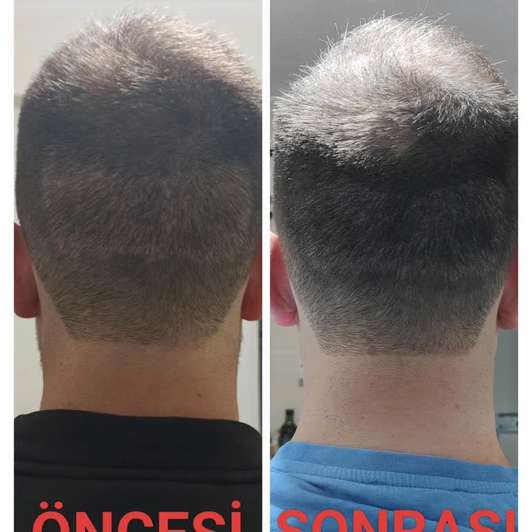 SMP İşleminde Beklenmeyen Sonuç Ve Ücret İadesi Sorunu