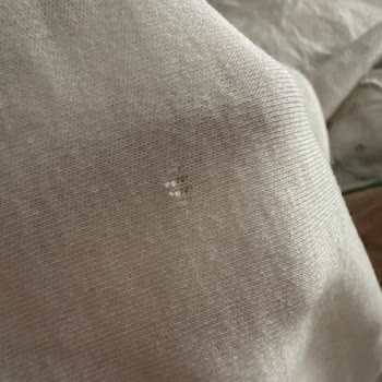 Zara Bebek Kıyafetinde Defolu Ürün Ve Etiket Sorunu