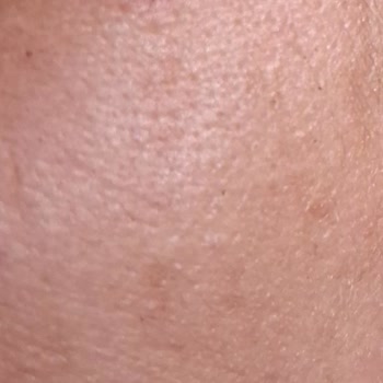 Duru Okyanus Duş Jeli Cildimde Alerjiye Sebep Oldu