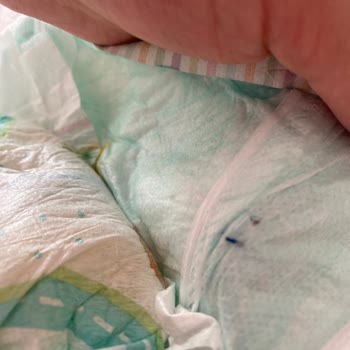 Bebek Bezinde Kıymık Şoku Ve Müşteri Hizmetleri Sorunu