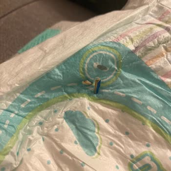 Bebek Bezinde Kıymık Şoku Ve Müşteri Hizmetleri Sorunu