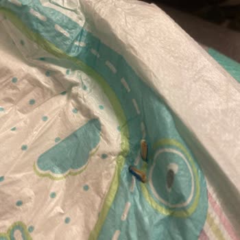 Bebek Bezinde Kıymık Şoku Ve Müşteri Hizmetleri Sorunu