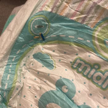 Bebek Bezinde Kıymık Şoku Ve Müşteri Hizmetleri Sorunu