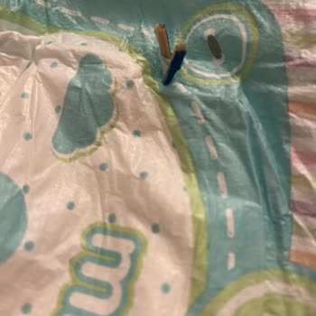 Bebek Bezinde Kıymık Şoku Ve Müşteri Hizmetleri Sorunu