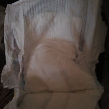 Molfix Bebek Bezlerinde Beklenmeyen Kalite Sorunu