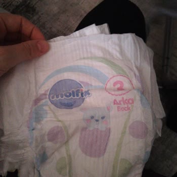 Molfix Bebek Bezlerinde Beklenmeyen Kalite Sorunu