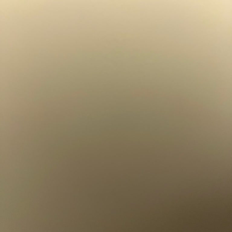 Sürekli Aramalar Ve Yüzüme Kapatılan Telefonlar