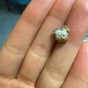 Fıstıklı Helvada Taş Çıktı, Dişimiz Kırıldı!