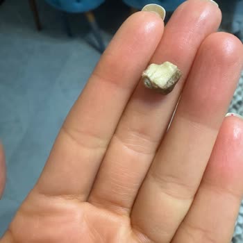 Fıstıklı Helvada Taş Çıktı, Dişimiz Kırıldı!