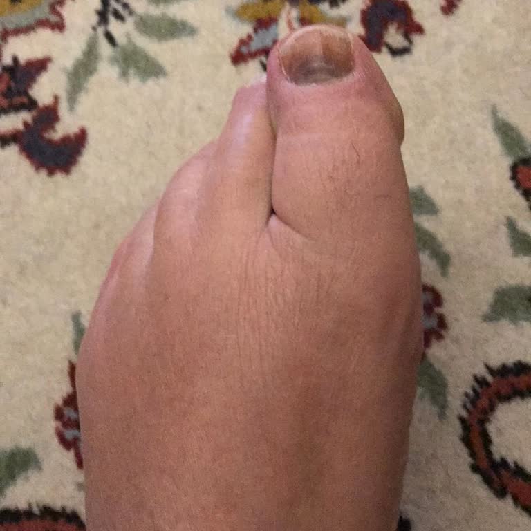 Yeşil Kundura'dan Aldığım Botun Rahatsızlığı Ve İlgisizlik