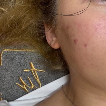 Hijyen Ve Kalite Sorunlarıyla Dolup Taşan Güzellik Merkezi Deneyimi