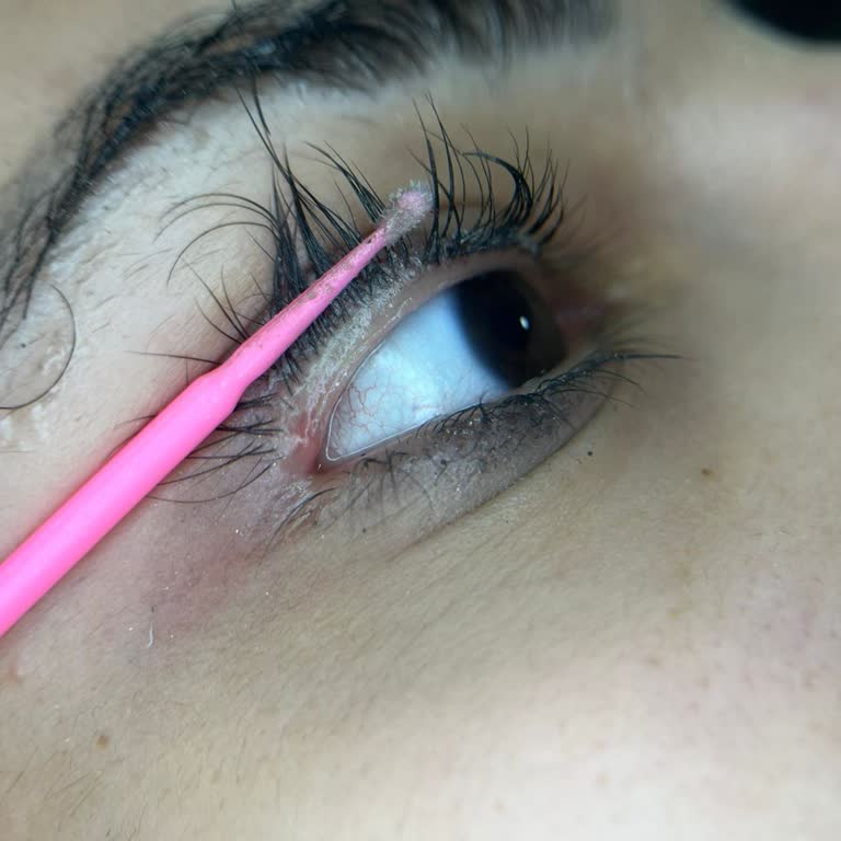 Valeria Platinum Beauty Kirpik Uygulaması Sonrası Göz Sağlığı Tehlikede!