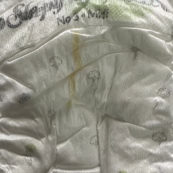 Sleepy Bezlerde Sarı Çizgi Sorunu