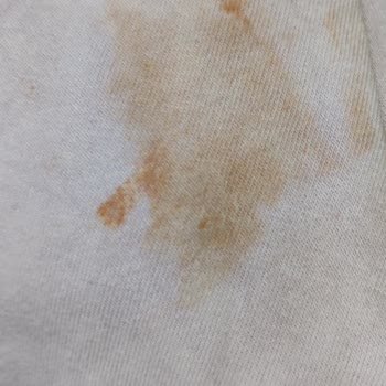 Leke Çıkarıcı Renkleri Soldurdu Kıyafetler Çöp Oldu