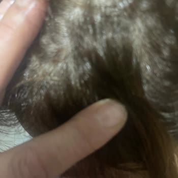 Palette 7.3 Hair Dye Caused Severe Scalp Burns and Pain