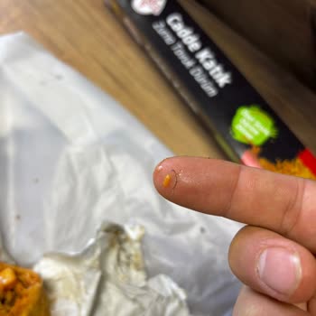 Zurna Dürümde Bulaşık Teli Şoku Ve Gizli Servis Ücreti