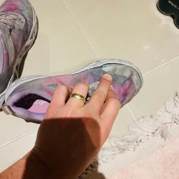 3 Ayda Dağılan Skechers Ayakkabılar Ve İlgisiz Müşteri Hizmetleri