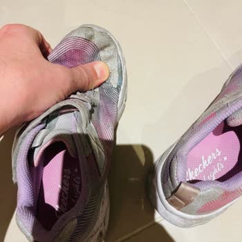 3 Ayda Dağılan Skechers Ayakkabılar Ve İlgisiz Müşteri Hizmetleri
