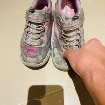 3 Ayda Dağılan Skechers Ayakkabılar Ve İlgisiz Müşteri Hizmetleri