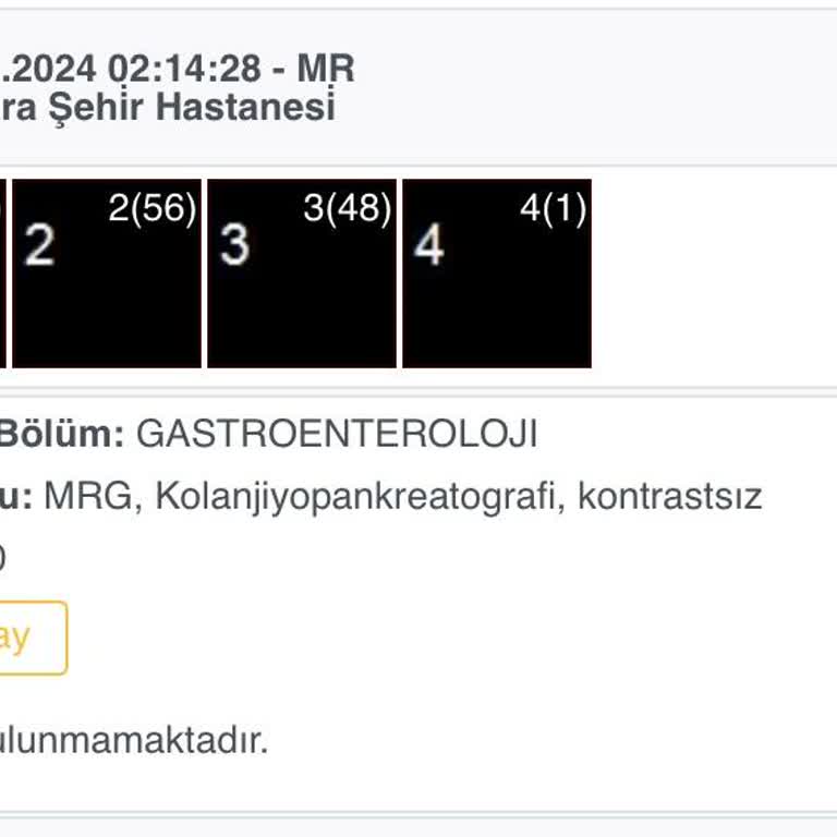Emar Sonuçları İçin Uzun Bekleyiş