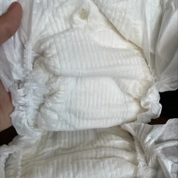 Bebek Bezinde Beklenmedik Madde: Molfix Pure & Soft Güvenilirliği Sorgulanıyor