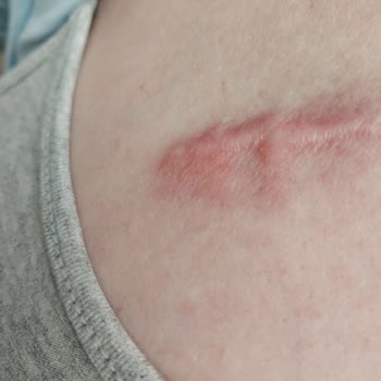 Estetik Operasyon Sonrası İletişim Ve Hizmet Sorunları