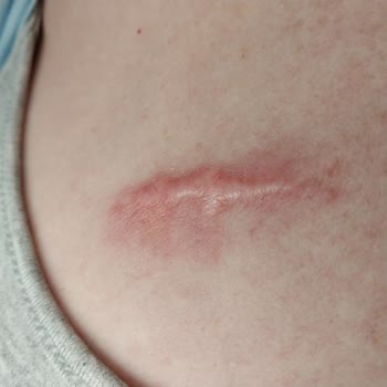 Estetik Operasyon Sonrası İletişim Ve Hizmet Sorunları