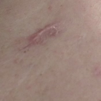 Estetik Operasyon Sonrası İletişim Ve Hizmet Sorunları