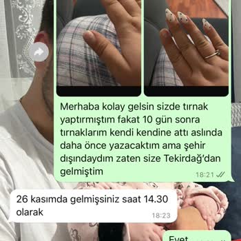 Protez Tırnak Hizmetinde Hayal Kırıklığı