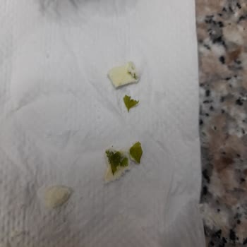 Bebek Maması Kalıp Ve Yeşil Madde Sorunu