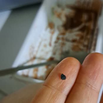 Dondurmadan Çıkan Taş Parçası Şoku