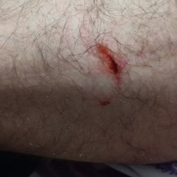 Sahipsiz Köpekler Tehlike Saçıyor: Kaş Belediyesi'ne Acil Çağrı