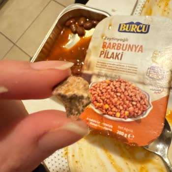 Burcu Gıda Barbunya Pilakide Taş Çıkması Ve Diş Ağrısı!