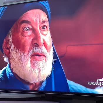 Arçelik Televizyonunda Sürekli Tekrarlayan Arıza Sorunu