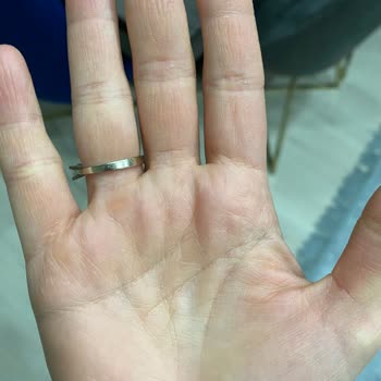 Sleepy Sıvı Sabun: Beklenmedik Cilt Sorunları