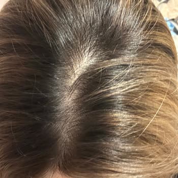 Beklenmedik Bir Kuaför Deneyimi: Saçlarımın Yıpranışı