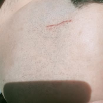 Wilkinson Jilet Ağzı Bozuldu Tam Tıraş Olurken Cildimi Kesti!