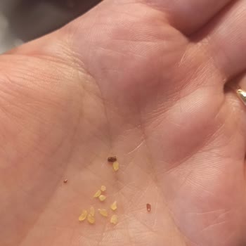 Duru Bulgurda Böcek Ve Siyah Maddeler Şoku