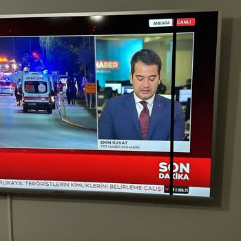 Onvo TV'de Sürekli Çizgi Ve Işık Sorunu