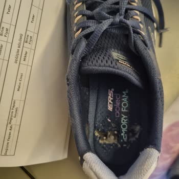 Skechers Ayakkabı İç Tabanı Sorunu Ve Müşteri Memnuniyetsizliği