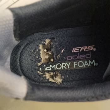 Skechers Ayakkabı İç Tabanı Sorunu Ve Müşteri Memnuniyetsizliği