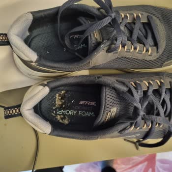 Skechers Ayakkabı İç Tabanı Sorunu Ve Müşteri Memnuniyetsizliği
