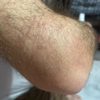 Tahta Kurusu Sorunu Ve İstikbal'den Yetersiz Hizmet