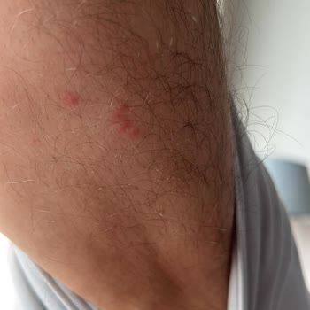 Tahta Kurusu Sorunu Ve İstikbal'den Yetersiz Hizmet