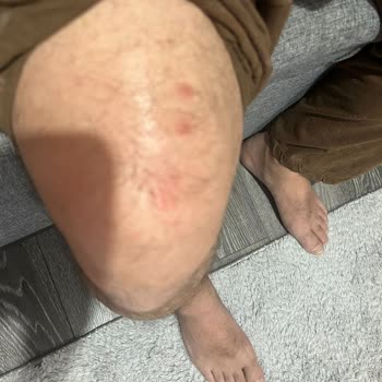 Tahta Kurusu Sorunu Ve İstikbal'den Yetersiz Hizmet